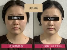 リアライズ(realise)の雰囲気（小顔・たるみ・しわ・しみ・ニキビ・毛穴など肌悩みを根本改善！）