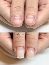 マリーロール 梅田店(Marie Laure)/自爪育成/深爪矯正/ネイルケア