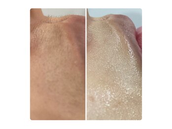 アネラ キキ サロン(anela kiki salon)/シェービングエステ