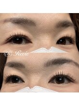 レビー(Revie)/フラットマット つけ放題