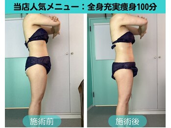 ナナ 銀座(Nana)/サイズダウンしたい方おすすめ