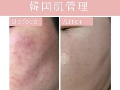 リメンテ 池袋東口店(REMENTE)の写真