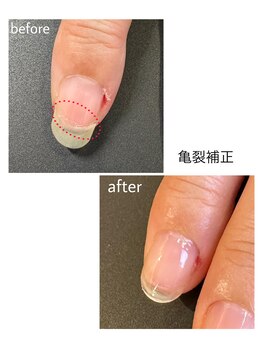 ケアプラス(care plus)/亀裂補修