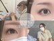 ディッチャ(Dicha)の写真