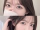 ベル リラ(Belle Lilas)の写真/【江坂】超軽量×高持続力!束感のある目元に!モチ良いLEDマツエク/フラットラッシュ100本(オフ込)￥5000