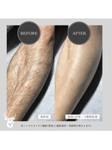 グランズ 芦屋(GLANZ)/Before→After