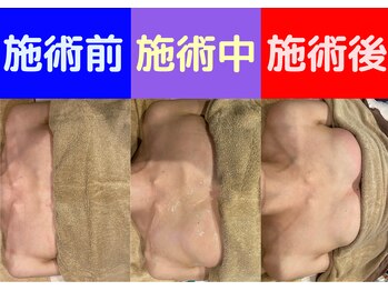 セブンシーズ 上野店(Seven Seas)/独自技術！葉月式 バストアップ