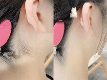 ネリネ 天神(nerine)/うなじWax脱毛♪ワックス脱毛