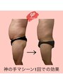 エピ(ep) 100キロ超えのお客様も1回でこんなにお腹引き締まります◎