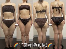 サロンドココ(Salon de COCO)/ハイパーナイフ/全身痩身/美姿勢