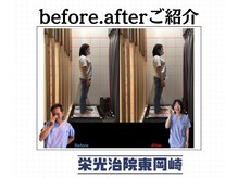 栄光治院 整体院東岡崎/東岡崎/整体/肩こり/骨盤矯正