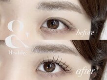 リノモア(LinoMoa)/&healthy(アンドヘルシー)