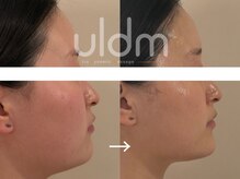 スワン 大阪南堀江(swan)/あご下のお肉が気になる方