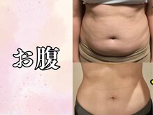 ヨサ パーク ルル(YOSA PARK Lulu)/たるたるぽっこりお腹もキュッ！