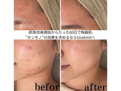 アンリミット 心斎橋店(Une limit)の写真