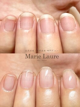 マリーロール 淀屋橋本店(Marie Laure)/深爪矯正/自爪育成/ネイルケア