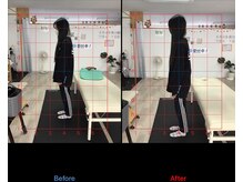 ストレチックス 近江八幡店/姿勢改善ビフォーアフター1回