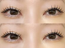 デザインケー 盛岡店(designK)/左右差も改善♪