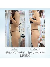 エスプレッソ(espresso,)/【半身痩身】華奢な二の腕GET