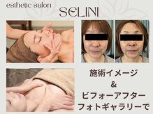 セリーニ(Selini)