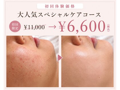 ミュー 金山店(mieux)の写真