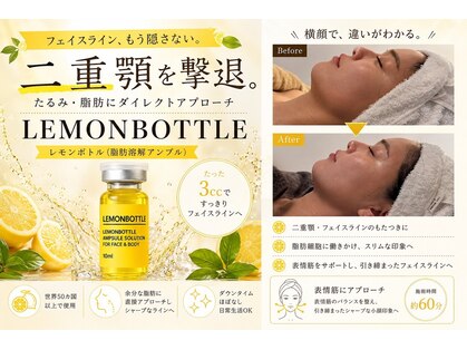 ヒノア(Hinoa)の写真
