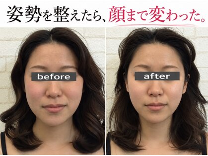 エメリリアビゼ 麻布十番(Aimerlilia bisser)の写真