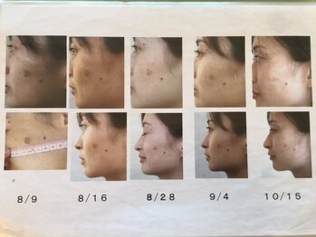 ビューティークリニーク アマーレ(Amare)/