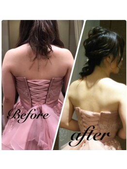 トリニティ 横浜店(TRINITY)/ブライダルエステ