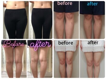 激痛ダイエット整体 八巻