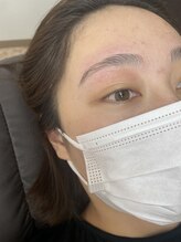 ルアナ(Ruana)/ハリウッドブロウリフト