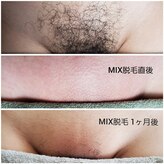 ワクシングサロンミラー(Waxing salon MIRROR)