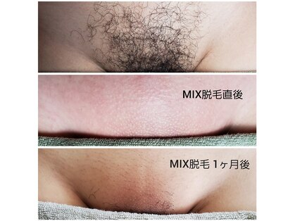 ワクシングサロンミラー(Waxing salon MIRROR)の写真