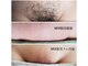 ワクシングサロンミラー(Waxing salon MIRROR)の写真