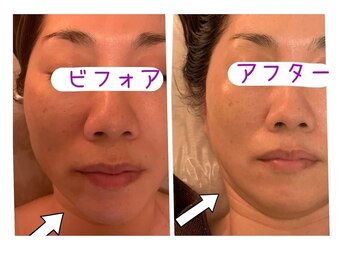 エステ ド あーと/before/after