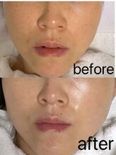 ナチュラ ソース(NatureSouce)/