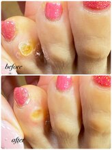 ラヴィ(La vie)/指の間にも魚の目