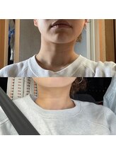 和鍼灸整骨院 イオン若松院/効果実感