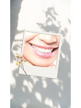 ミース 自由が丘店(MYS)/どんな歯も白く!