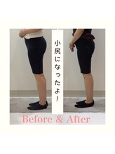 スタイルラボ高松/産後の骨盤矯正の効果♪