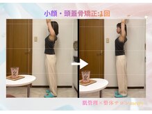 メリー 大和西大寺店(merry)/小顔・頭蓋骨矯正Before after★