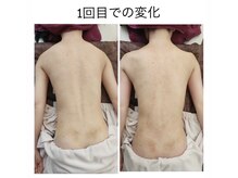 ミエリフル(Miel et Fleurs)の雰囲気（巻肩、なで肩も頭皮が変われば身体も変わる）