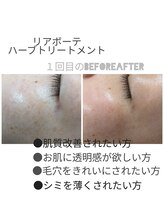 ラトゥール(Latour)/ハーブトリートメント