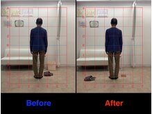 整体院 仁(JIN)/#ぎっくり背中#背部の痛み#腰痛