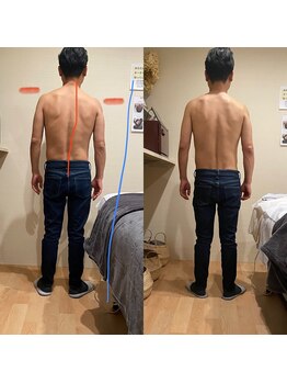 トトノエル(TOTONOEL)/ゆがみ矯正筋膜リリース