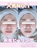 ＜人気NO,1☆ツヤ肌 ＞水光ピーリング 70分 12,000→9,800円