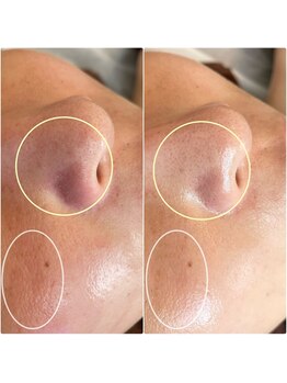 クロッシュ(Cloche)/シミ・シワ・たるみ改善サロン