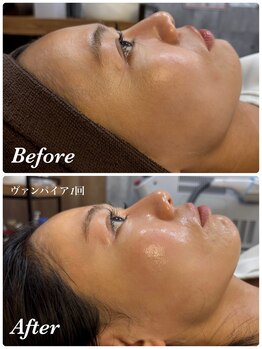 ミランオオサカ(MIRAN OSAKA)/