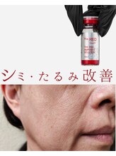 プレイス 太融寺店(PLACE)/redshot　理想の小顔へ