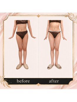 プロラボスパ 姫路店/20代後半　症例写真